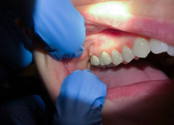Best Pediatric Emergency Dentist in Midland, WA